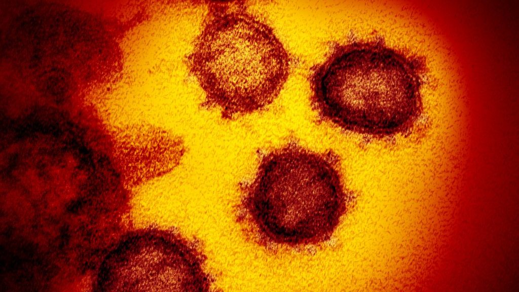 Summer Surge: As Coronavirus Infections Rise In Maryland, Some Reveal Why They Won’t Get Vaccine; Hogan Says ‘Breakthrough’ Infections Under 1%